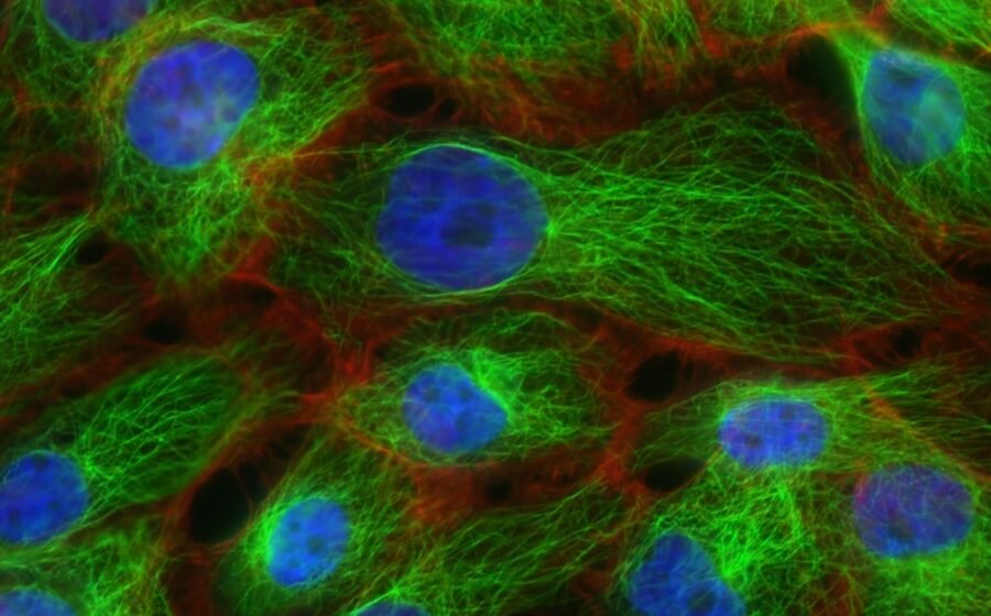 Fluorescence microscopy image of biological cells, illustrating cellular research; not a microscopy image of mitochondria specifically